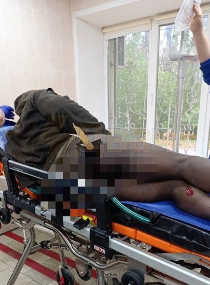 Врачи вытащили из задницы нигерийца деревянный кол 41-летний гражданин Нигерии попал к врачам в Липецке с весьма необычной проблемой — в его «филей» был вонзён приличных размеров деревянный кол. Врачам он сообщил, что на кол он упал случайно, охотников на вампиров замечено не было. Он лишь пытался перебраться через забор, но потерял равновесие и упал на штакетник. Скорая доставила заборного акробата в больницу с сильным кровотечением. Деревяшку удалили, теперь чернокожему липчанину предстоит период реабилитации и сон на животе.