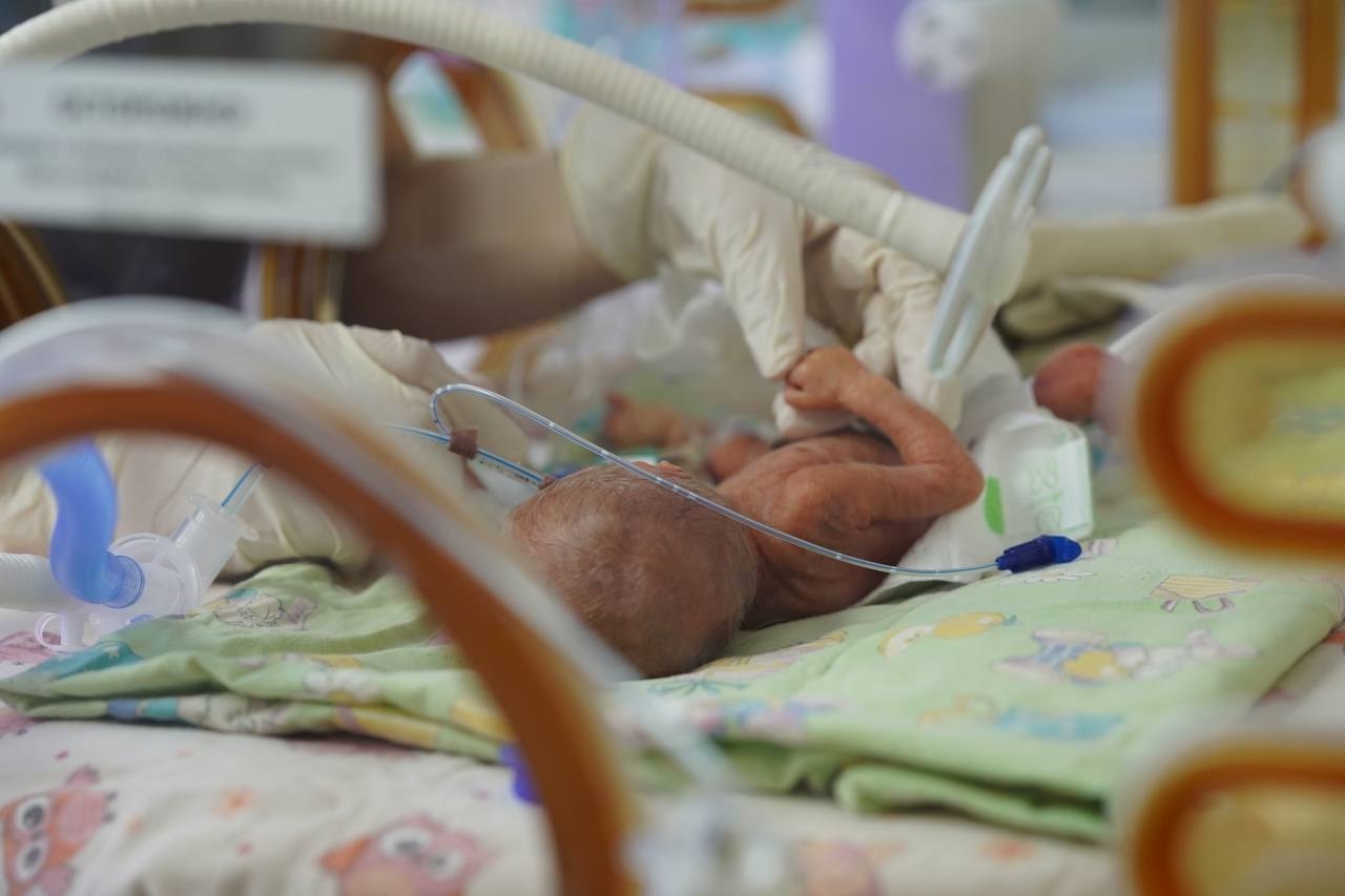 17 ноября Всемирный день недоношенных детей В Петербурге доля недоношенных детей на протяжении последних лет остается стабильной 5 5 процента от общего числа новорожденных Петербургские врачи достигли больших успехов в их выхаживании Специалистам удается спасать более 85 процентов младенцев родившихся с экстремально низкой массой тела Такие малыши весят менее 1 килограмма На всю Россию прогремел случай когда нашим врачам в 2023 году удалось спасти мальчика который родился весом 320 граммов По поручению Президента мы системно улучшаем подходы к сохранению здоровья новорожденных Петербургская неонатологическая служба одна из лучших в России Наших врачей и медсестёр отличают профессионализм и самое трепетное бережное отношение к жизням маленьких пациентов Важно что медицинские работники Северной столицы участвуют в жизни своих воспитанников и после выписки радуются их первым шагам и успехам сказал губернатор Александр Беглов В Детской городской больнице 1 сегодня пройдёт праздник приуроченный к Международному дню недоношенных детей Родители и уже подросшие дети смогут пообщаться с докторами поблагодарить их и поделиться радостными новостями о достижениях своих малышей Больница на Авангардной является ведущим центром по выхаживанию недоношенных детей в нашем городе