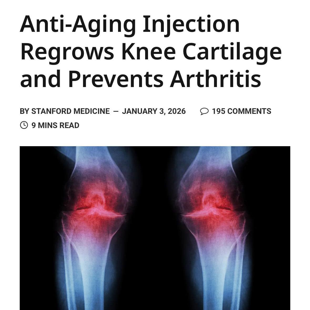 Учёные разработали метод восстановления хряща прямо внутри коленного сустава Проблема заключалась в белке 15 PGDH который препятствовал регенерации тканей Его подавление одной инъекцией у мышей запустило рост хряща снизило боль и остановило развитие артроза Аналогичный эффект удалось достичь и на человеческом хряще В перспективе лечение коленей может ограничиться простым уколом или приёмом таблетки Подпишись на нас в МАХ