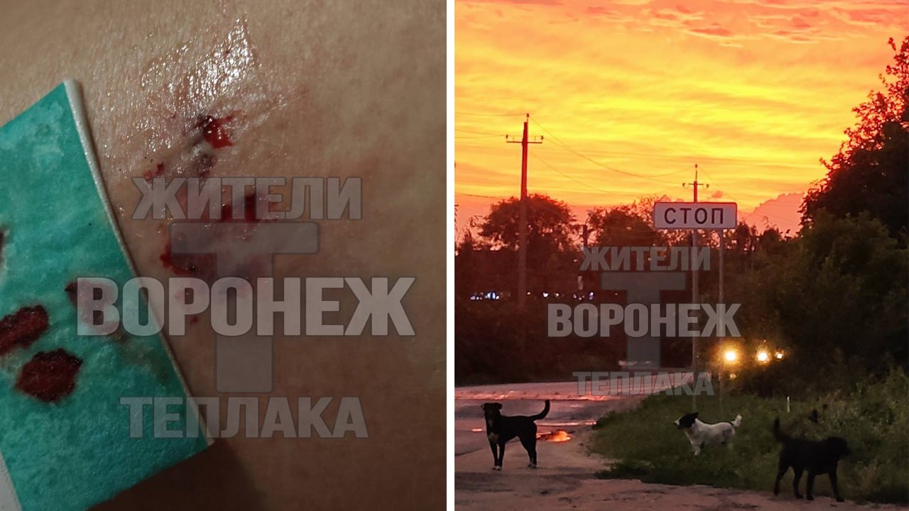 Стая собак напала на девушку в коттеджном посёлке «Гардарика»   Животные выскакивают из кустов и кидаются на людей. Девушка отметила, что дворняги уже давно живут на территории посёлка. Их якобы подкармливают сотрудники одной из местных фирм.   – Я к собакам отношусь спокойно, поэтому немного подождала пока они успокоятся и уйдут. Медленно начала отступать в противоположную сторону, но получила укус в ногу. К этому я не была готова, – рассказала местная жительница.   Следственный комитет возбудил уголовное дело об оказании услуг, не отвечающих требованиям безопасности.   Фото: Жители Теплака