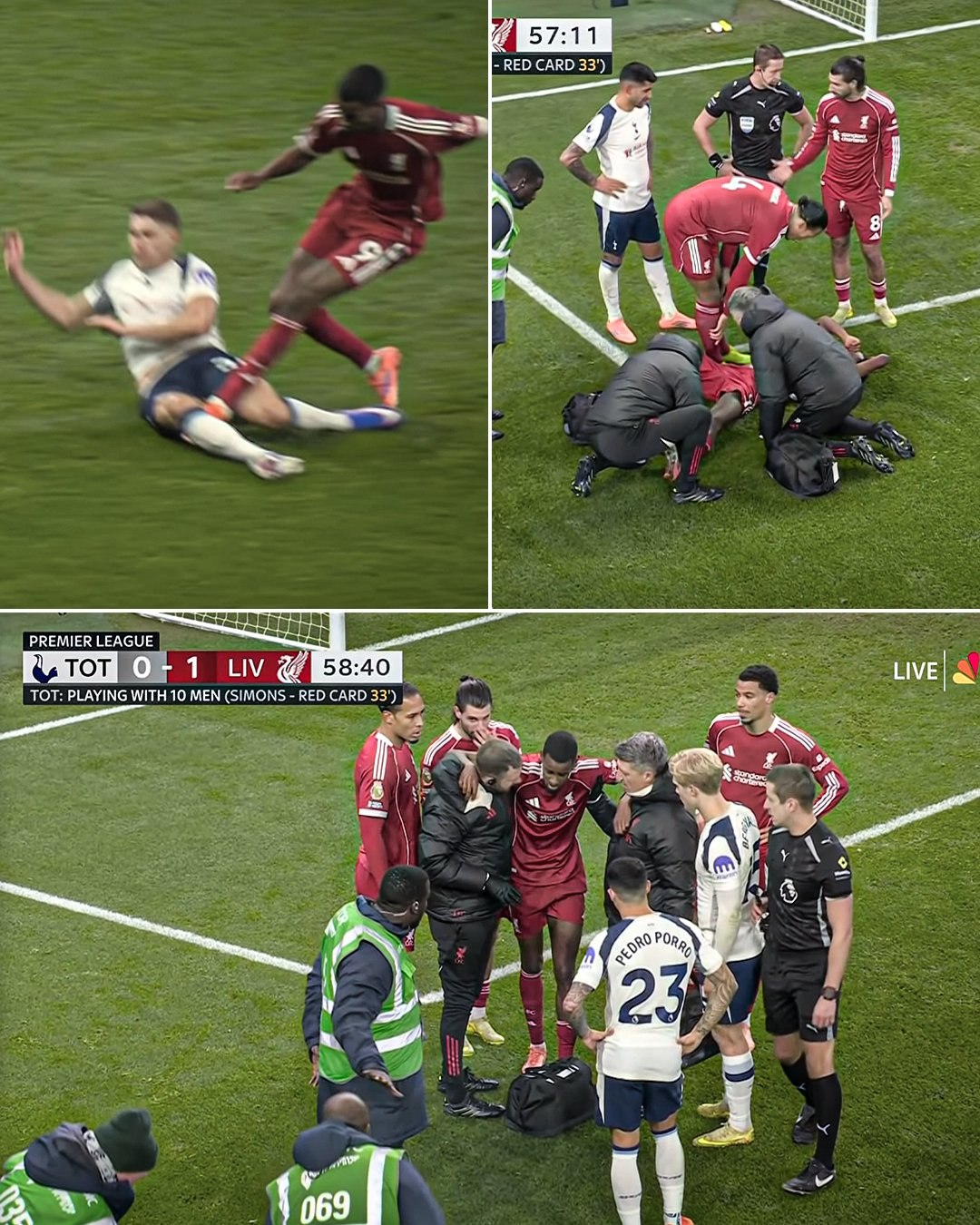 У Александера Исака подозрение на разрыв крестообразных связок Physio Scout Форвард Ньюкасла получил страшную травму после удара по голеностопу его колено выгнулось в неестественное положение Если диагноз подтвердится швед может выбыть на длительный срок