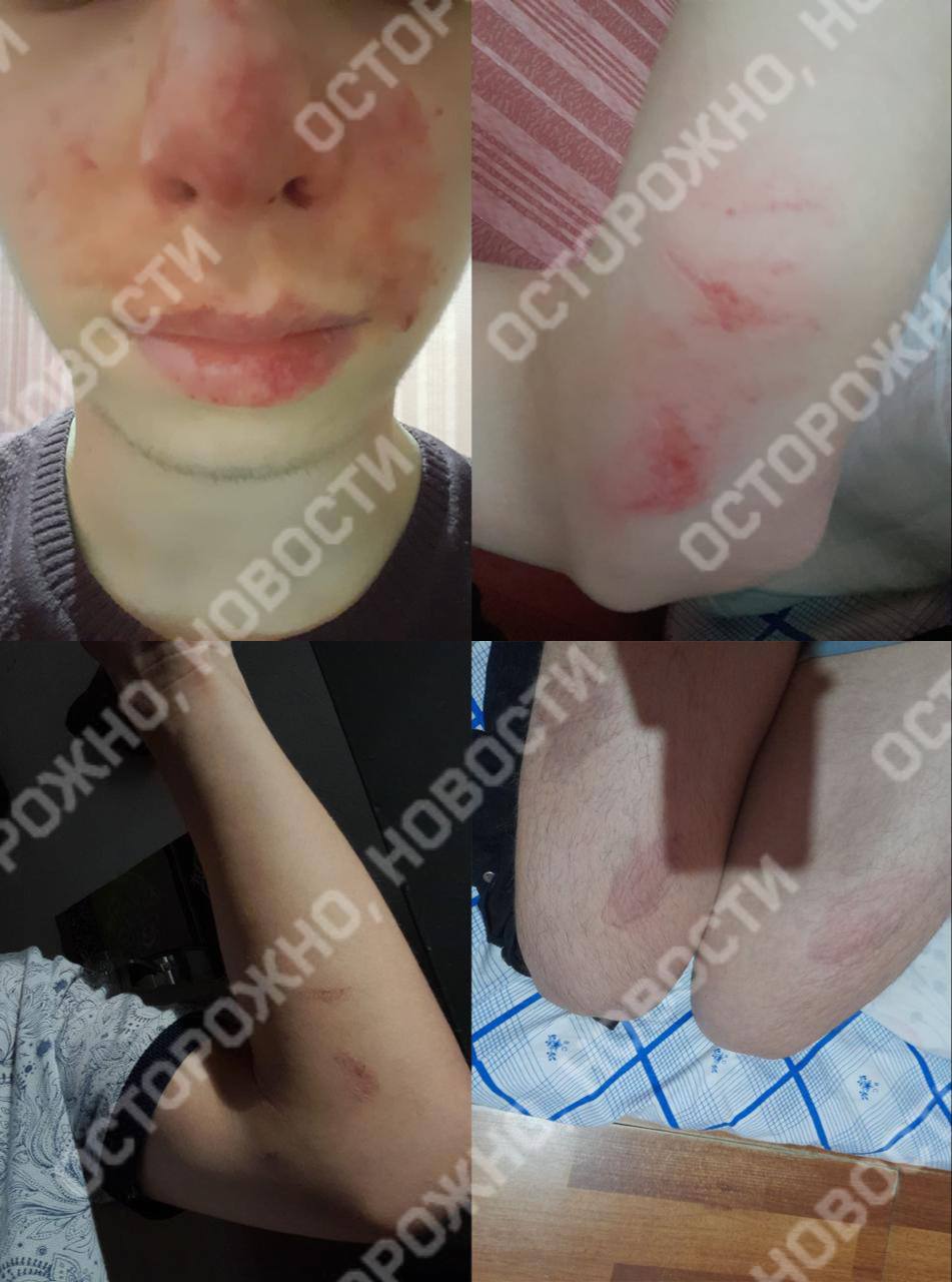В Ингушетии пропал подросток, которому угрожали убийством родные – СМИ  В Ингушетии пропал 16-летний Ислам Мусиев  до смены имени — Зелимхан Темирханов , который жаловался правозащитникам на угрозы на побои в семье и угрозы со стороны родных об «убийстве чести», пишут «Осторожно, новости» со ссылкой на проекте «СК SOS» и «Кавказ без матери».    Правозащитникам подросток показывал фото с синяками, говорил об угрозах убийством, избиениях и просил увезти его из региона, однако это было сложно из-за его возраста. Позже они добились, чтобы на ситуацию обратила внимание инспекция по делам несовершеннолетних: к Исламу ездила начальник ПДН Назрановского района Лейла Могушкова.   «Она сообщила правозащитникам, что побеседовала с семьей. Через неделю после её визита Ислам перестал выходить на связь. Незадолго до пропажи он просил подать заявление, если не будет отвечать дольше двух дней. В своей смерти он просил винить Мусиева Хасана Алиевича, Мусиева Ричарда Хасановича и Мусиева Магомеда Алиевича»,  – пишет издание.   Мусиев не выходит на связь больше недели, а отправленные ему сообщения не доходят до адресата. Могушкова в разговоре с журналистами сначала заявила, что никогда не была дома у семьи и не занималась этим делом, а позже перестала отвечать на сообщения.   В правоохранительных органах ситуацию к вечеру 2 июля не комментировали.     Ранее «Фортанге» рассказывала историю жительницы Ингушетии Айны Манкиевой. 20-летняя студентка в конце апреля ушла из дома, а спустя несколько дней заявила, что приняла решение добровольно и опасается возвращаться домой.   По данным источника в силовых структурах, Айна еще во время учебы в школе жаловалась в прокуратуру на насилие со стороны различных родственников.   #Ингушетия #Фортанга #НовостиИнгушетии