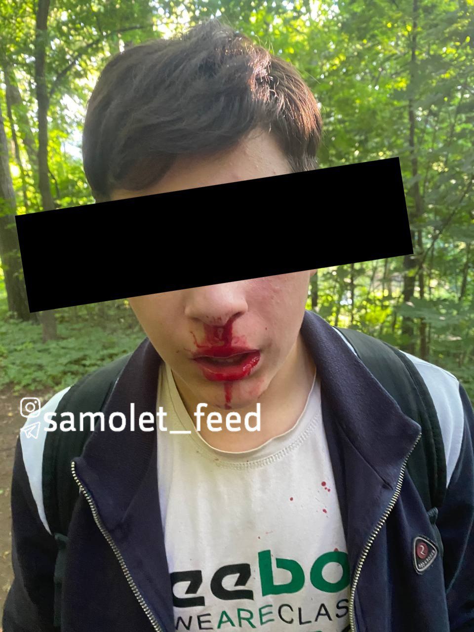 В Зенинском парке г. о. Люберцы неизвестный напал на двух 14-летних подростков По рассказу самих парней, мужчина начал агрессивно приставать к ним с вопросом, что они делают в лесу. Когда подростки ответили, что идут в парк, мужчина набросился на них, используя в качестве оружия карандаш и камень. В результате нападения одному подростку повредили палец, а второму — разбили нос и сломали телефон. 1 Подпишись Поделись новостью