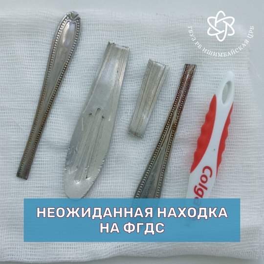 Достали из желудка странные вещи  Четыре металлических предмета и часть зубной щётки извлекли из желудка мужчины в Ишимбайской ЦРБ.  46-летний пациент три дня мучился от сильных болей, но не мог понять их причину.  Обследование показало наличие инородных тел в желудке. Врачи смогли удалить все предметы без операции.   Мужчину уже выписали из больницы.  Как именно они оказались в желудке — остаётся загадкой
