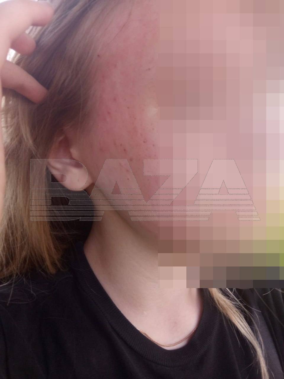 Водитель избил и выгнал школьницу из автобуса, заподозрив в том, что девочка не оплатила проезд. Это произошло в Тверской области. Подросток утверждает, что оплата прошла, но из-за отключений интернета в регионе водителю не пришло уведомление об оплате. Вечером 4-го июля 14-летняя Маша имя изменено села в автобус №13 в деревне Юрятино Ржевский район . Девочка утверждает, что оплатила проезд по СБП и закрыла вкладку, но позже, когда водителю не пришло уведомление об оплате, он решил, что школьница пытается проехать «зайцем». Мужчина начал требовать подтверждения оплаты. Маша стала пытаться прогрузить приложение банка и показать чек транзакции, но тщетно – интернет не работал. Тогда разъяренный водитель сначала долго кричал на подростка и требовал либо покинуть салон, либо показать чек, а потом разбил девочке телефон, и, нанося удары, силой выволок Машу из автобуса. После случившегося Маша позвонила маме – женщина нашла дочь на остановке избитую и в шоковом состоянии. Девочку рвало, по словам матери, у дочери была вырвана прядь волос. Они тут же отправились в больницу – медики диагностировали у школьницы множественные ушибы, ссадины, гематомы и сотрясение мозга. Машу госпитализировали. Сейчас мать девочки пытается починить разбитый телефон, чтобы доказать, что оплата за проезд все-таки прошла. По данным «Базы», водитель автобуса задержан, свою вину он не признает, утверждая, что Маша сама виновата. Подписывайтесь, это Baza