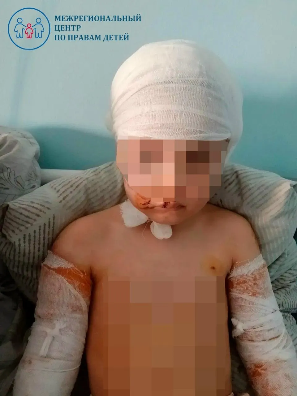 Стая бродячих собак напала на ребенка в Красноярском крае Инцидент произошел в поселке Диксон Пятилетняя девочка играла на детской площадке когда отец ненадолго отошел в магазин В этот момент на нее набросились бродячие собаки Спас девочку случайный прохожий который отогнал животных Малышка получила серьезные раны лица головы и рук Еще в 2024 году прокуратура требовала от местной администрации организовать отлов бездомных псов но этого так и не сделали Возбуждено уголовное дело о халатности   Подпишитесь на Абзац в Mах