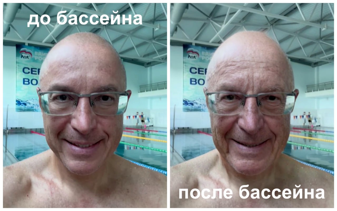 Россияне быстрее стареют из-за воды в бассейне, заявили учёные По словам химика Андрея Дорохова, хлорка ускоряет появление морщин, повреждая коллаген и эластин. А взаимодействие хлора с потом и косметикой может приводить к образованию хлораминов — соединений, ускоряющих фотостарение. Пошлите это депутату Гвоздеву! Подписывайтесь: 73online Присылайте новости