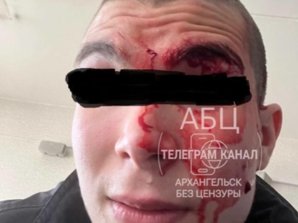 Студента архангельского техникума жёстко затыкавшего однокурсника циркулем ждёт суд 20 летнего новодвинца будут судить за нападение с циркулем на однокурсника которое привело к тяжелым травмам у пострадавшего Инцидент произошел 15 мая в Архангельском колледже телекоммуникаций имени Розинга Как установило следствие тогда один из учеников из хулиганских побуждений набросился с циркулем на другого студента Удары иглой приходились в лицо и шею но сильнее всего пострадал глаз пострадавшего Согласно заключениям экспертов повреждения глаза являются неизгладимыми Нападавший вину в совершении преступления признал в полном объеме Прокурором города в интересах несовершеннолетнего потерпевшего заявлен гражданский иск в размере 500 тысяч рублей в качестве компенсации морального вреда