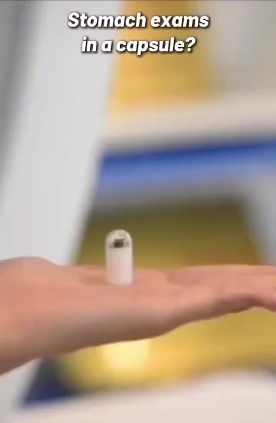 Китайская капсула заменяет колоноскопию: инновации в диагностике ЖКТ