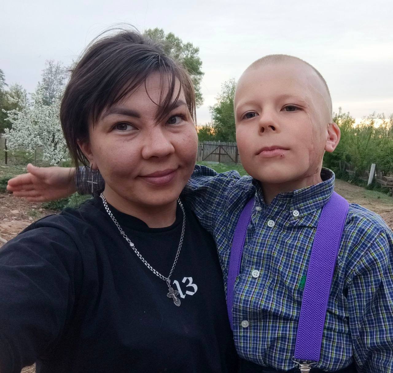 Хирурги РДКБ восстановили лицо пятилетнего пациента, которого переехал трактор Под колеса домашнего трактора мальчик попал в июне прошлого года. Ребенок получил тяжелейшие травмы — потеря трети всей кожи головы, скальпированные раны конечностей, лица, головы, переломы руки и ноги. В тяжелом состоянии в медикаментозной седации на аппарате искусственной вентиляции легких его экстренно госпитализировли в Российскую детскую клиническую больницу Минздрава России. Как рассказал Игорь Исаев, врач — детский хирург отделения реконструктивно-пластической хирургии РДКБ, обширная рана лица и волосистой части головы занимала треть поверхности. Несмотря на тяжесть травмы, мышечная ткань и проводимость лицевого нерва остались, что давало шанс сохранить нормальную мимику. На первом этапе лечения специалисты зафиксировали переломы конечностей и провели лечение ран на руках и ногах. Как отметил Игорь Владимирович, в ходе подготовки к масштабной пластической операции на лице важно было добиться чистой раны со здоровой грануляционной тканью: «После трех недель подготовки мы выполнили сложнейшую операцию — пластику свободным кожным трансплантатом. Поскольку дефект был очень большим, трансплантат состоял из нескольких фрагментов. Кожу взяли с боковой поверхности туловища, где она по текстуре наиболее близка к коже лица. Донорские же участки, откуда была взята кожа, мы аккуратно ушили для минимизации дальнейшего рубцевания». Для лучшего приживления пересаженных тканей использовали специальную повязку на лицо, поддерживающую влажную среду. Уже на седьмой день стало ясно, что трансплантат приживается отлично. Вскоре швы были сняты, и через 12 дней после операции ребенок был выписан. Контрольный осмотр показал, что был достигнут желаемый косметический эффект, функции и мимика лица полностью сохранились. В дальнейшем ребенку еще предстоит лазерная коррекция рубцов и тканей, чтобы цвет и текстура кожи максимально приблизились к естественным.
