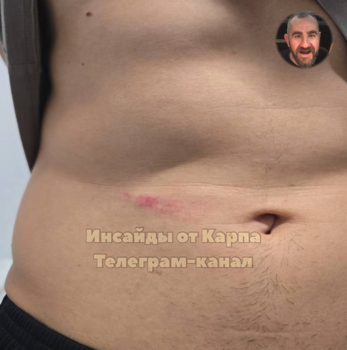 Станкович схватил Монтеса в перерыве дерби: после окончания 1-го тайма при счете 1:1 главный тренер Спартака направился к мексиканцу, чтобы предъявить ему за один из игровых эпизодов  у защитника Локомотива была желтая карточка, он получил ее на 29-й минуте за фол против Гарсии . На эмоции Деяна — Сесар грубо ответил сербу. В ответ Станкович прихватил Монтеса за торс, последствия чего вы можете видеть на фото, — докладывает Карп.