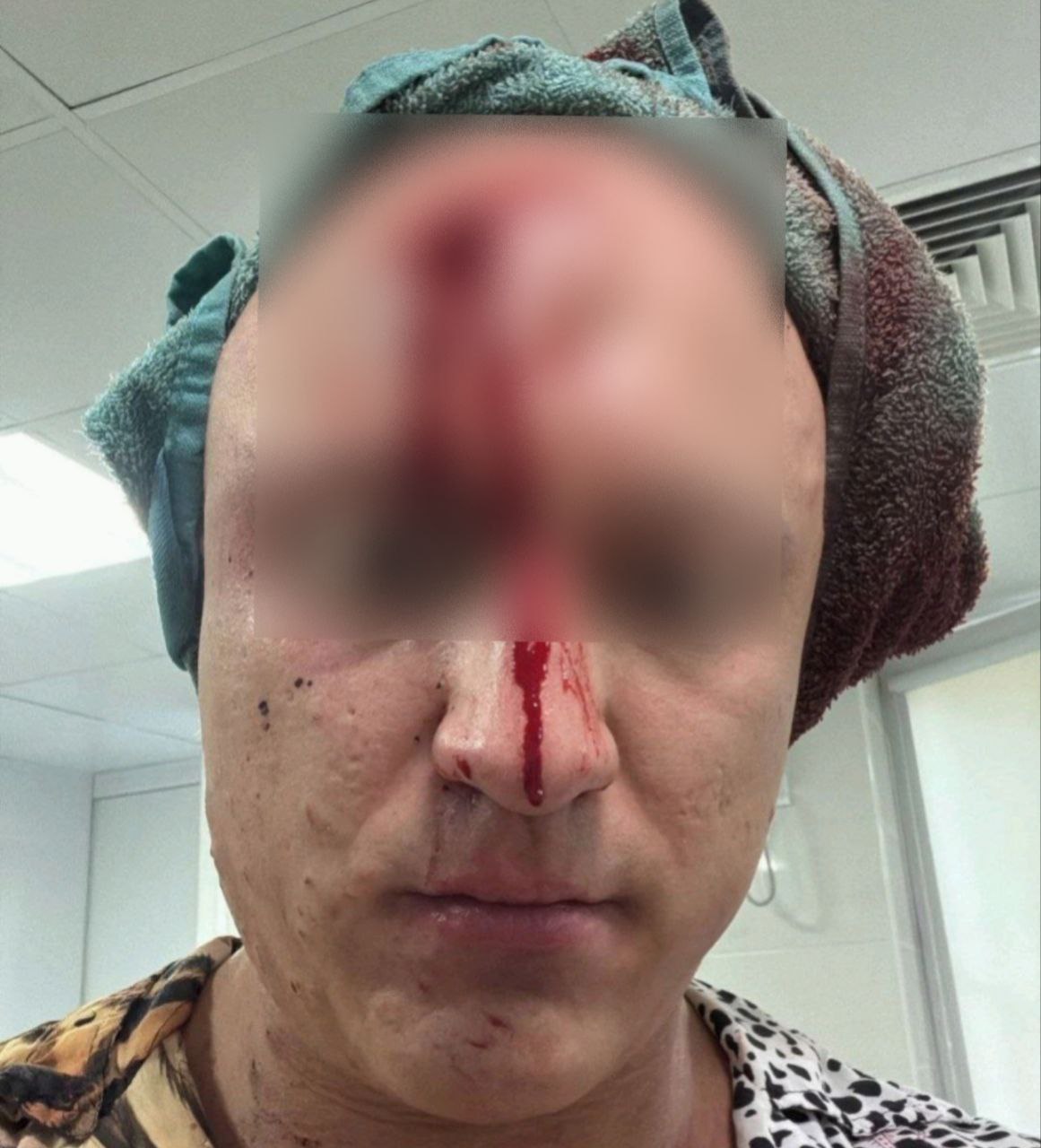 Мужчина получил пулю в лоб из травматического пистолета в центре Краснодара. Ночью 13 июля в Краснодаре на ул. Красноармейской между двумя мужчинами произошёл конфликт. Один из участников попытался уехать, но другой решил продолжить разборки — началась погоня. Во время преследования произошло ДТП, после чего один из мужчин открыл огонь по машине оппонента из травматического пистолета. Стрелка уже задержали, оружие изъято. Проводятся следственные действия. Уголовное дело возбуждено по ч. 2 ст. 213 УК РФ хулиганство с применением оружия , сообщили в полиции ТК Краснодар Подписаться