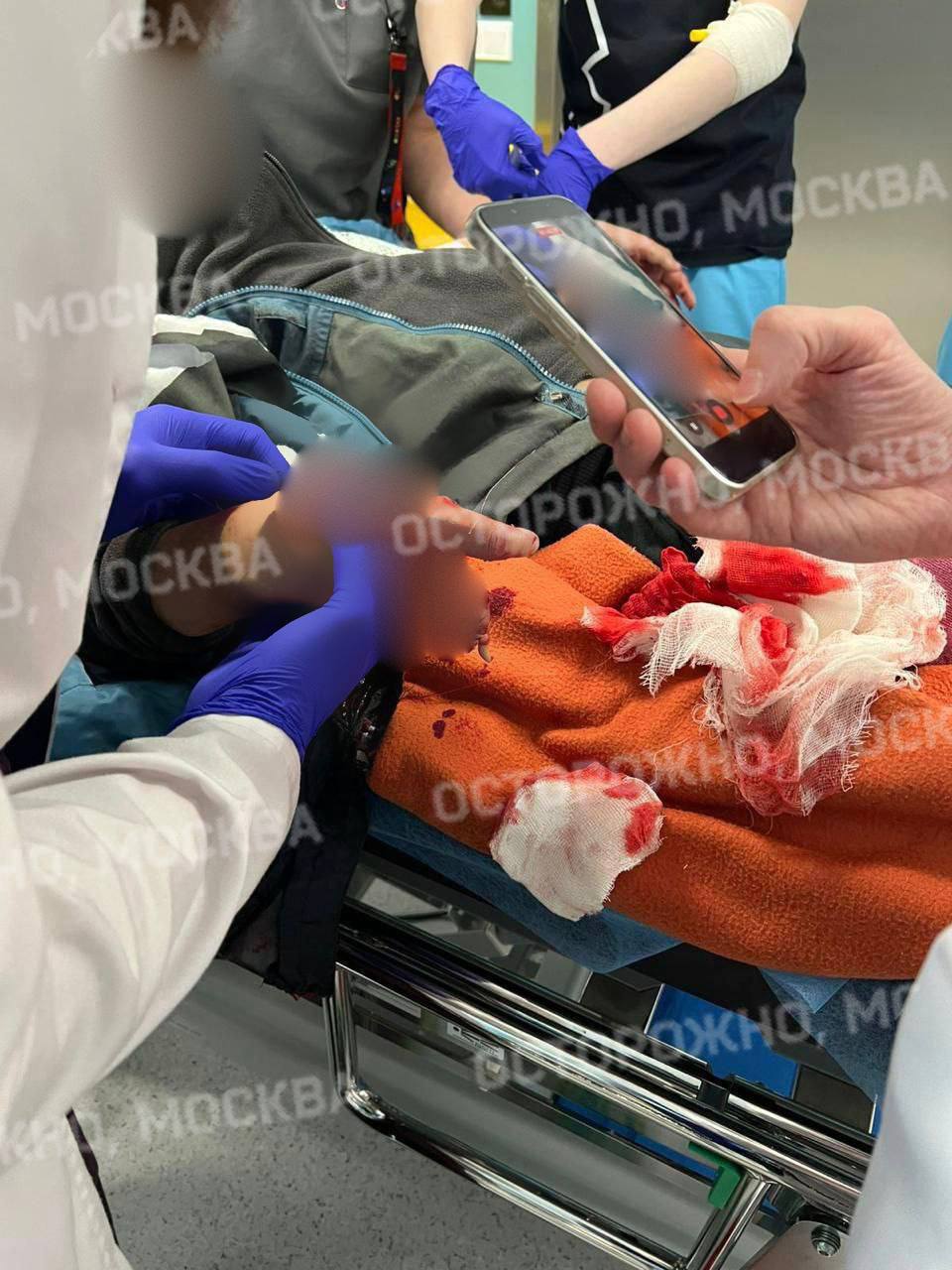 В Красногорске ребёнку оторвало пальцы после того как он поднял деньги рядом с детской площадкой 9 летний мальчик пострадал сегодня вечером на Пионерской улице Ребёнок шёл на тренировку увидел на земле деньги и попытался их поднять В этот момент произошёл взрыв По предварительной информации мальчику оторвало несколько пальцев Ребёнка забрала скорая В социальных сетях распространяется просьба к родителям и преподавателям провести беседу с детьми о недопустимости прикасаться к посторонним предметам Подписаться на канал Telegram MAX