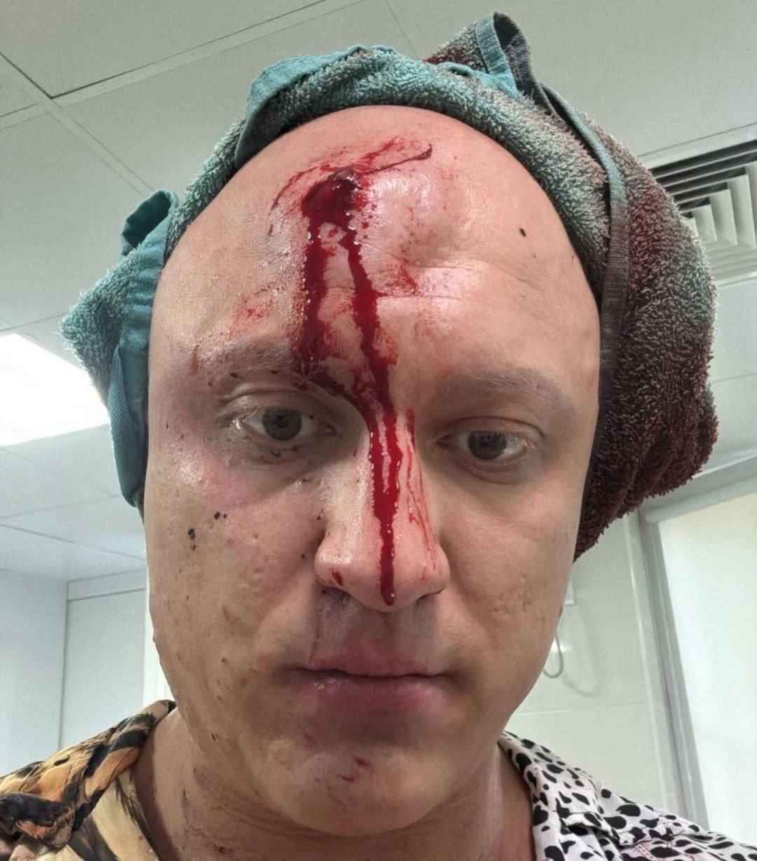 Ранен в голову, прооперирован дважды: Стрельба и врачебная ошибка в Краснодаре В центре Краснодара произошло нападение, закончившееся стрельбой и серьезным ранением. Несколько дней назад Владислав, отдыхавший в одном из городских заведений, стал объектом внимания двух мужчин. По словам потерпевшего, они потребовали у него наркотики. Получив отказ, нападавшие начали преследовать Владислава. Он успел уехать на своей машине, однако погоня продолжилась. В ходе нее преследователи открыли огонь. Пуля из травматического оружия попала Владиславу в лоб. В Зиповской больнице Краснодара ему провели операцию. Однако, как сообщил сам Владислав изданию "Альфа news", произошла серьезная врачебная ошибка: хирург зашил ему голову, не заметив пулю. Инородное тело в голове обнаружили только спустя несколько часов, после чего потребовалась повторная операция для его извлечения. Следы от пули также остались на машине потерпевшего. По информации источника, несмотря на тяжесть происшествия, подозреваемых в нападении отпустили под подписку о невыезде. Официальные комментарии от МВД Краснодара и администрации Зиповской больницы пока не предоставлены. Ситуация вызывает серьезные вопросы как о ходе расследования, так и о качестве оказанной медицинской помощи. Источник: Альфа News МедКрай Ваше здоровье