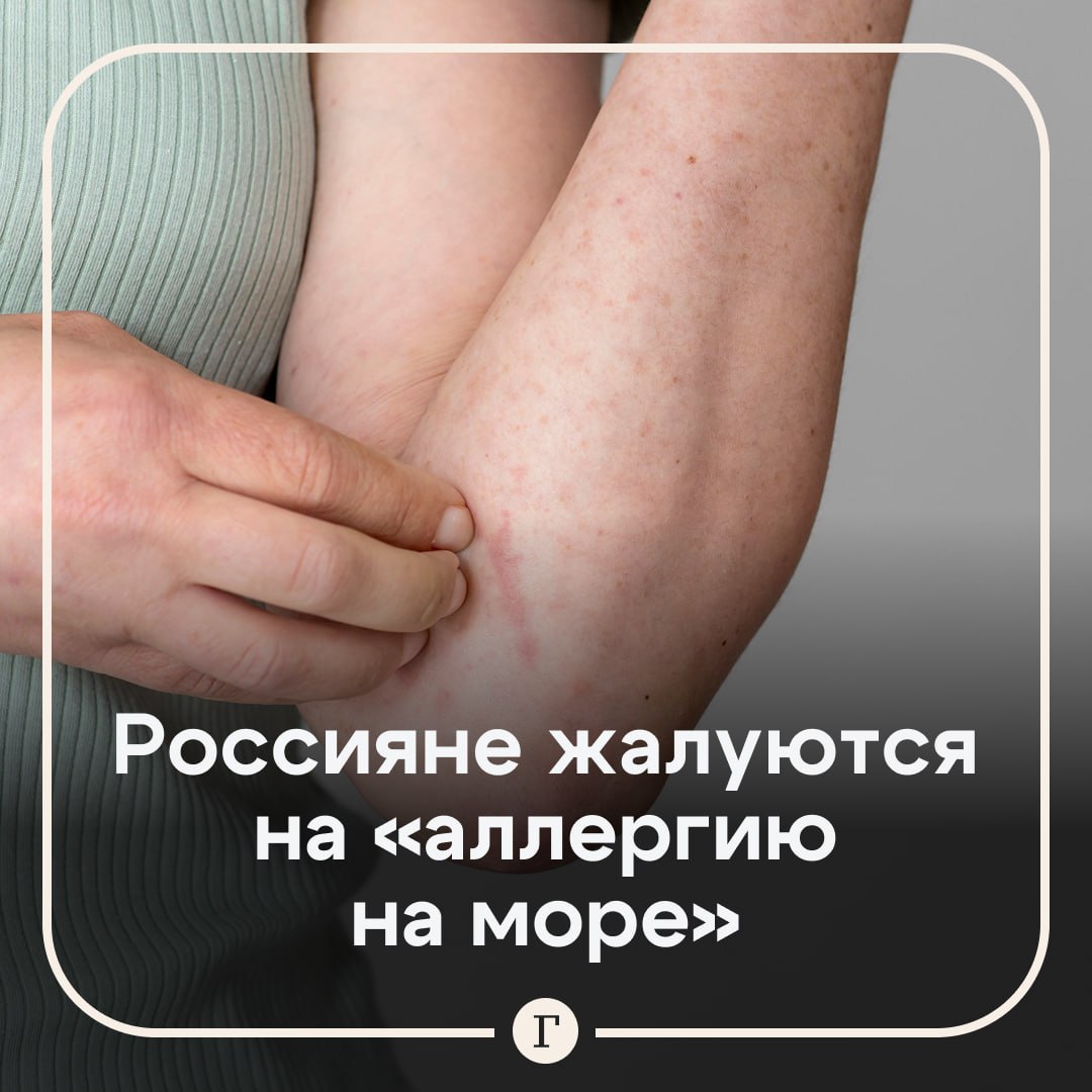 Россияне массово пожаловались на сыпь после купания в море за границей.  У туристов из РФ появляются кожные высыпания на курортах Турции, Египта и Мальдив. В местных клиниках врачи ставят диагноз «аллергия на море». Причиной называют высокий уровень ультрафиолета и экстремальную жару, которые могут вызывать подобные реакции даже у людей без хронических кожных заболеваний.  Симптомы, по словам туристов, исчезают в течение 3–5 дней после возвращения домой.    — В этом году не купаемся