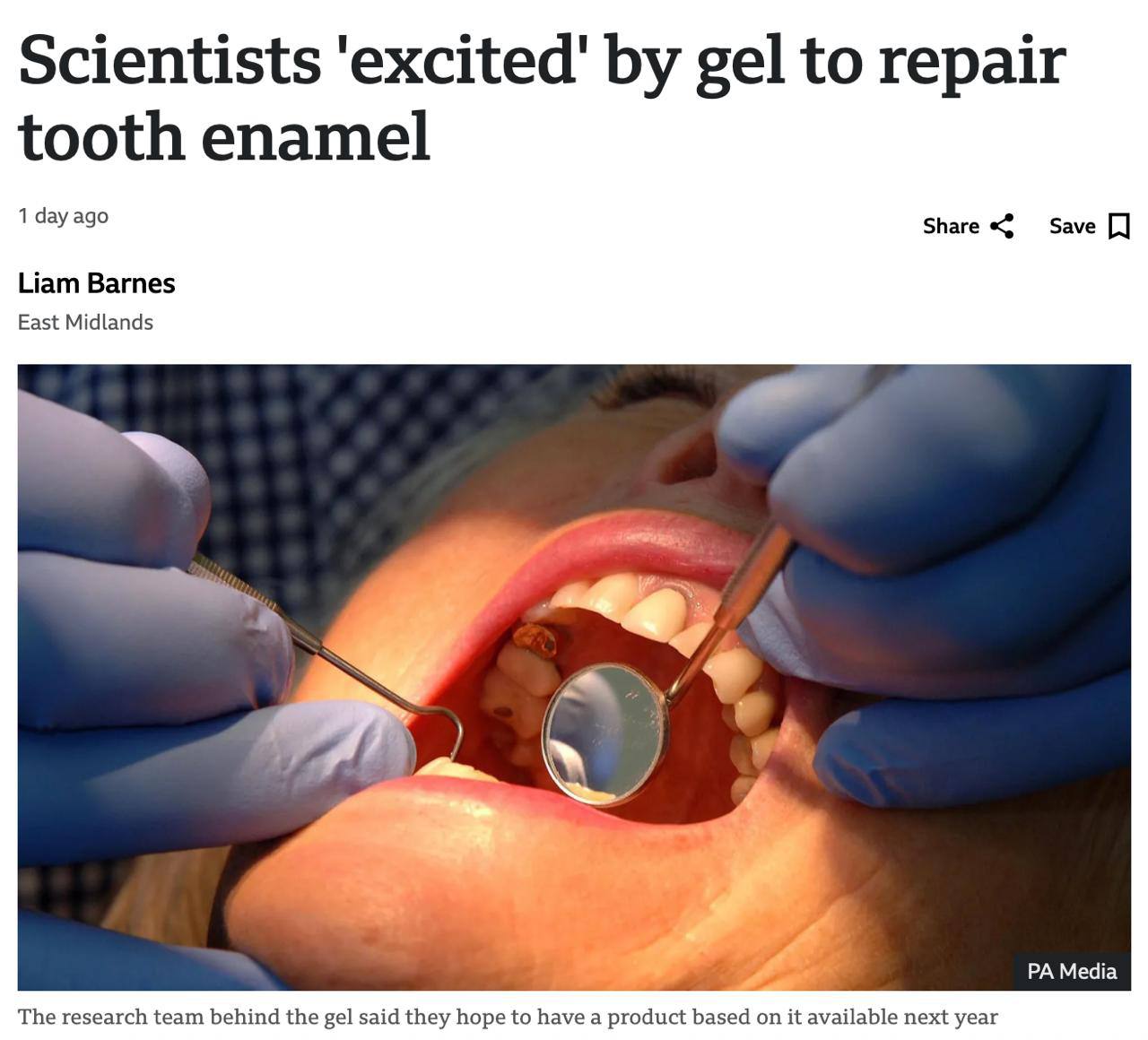 Учёные нашли способ вылечить кариес без бормашины с помощью геля из слюны Средство восстанавливает эмаль само достаточно нанести его на зубы Без пломб боли и визитов к стоматологу Тесты уже прошли успешно впереди массовые испытания Если всё подтвердится гель появится в аптеках media