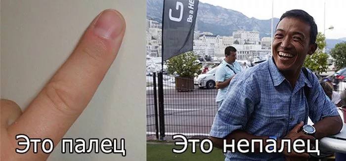 В Ростове девочке успешно пришили отрезанную фалангу пальца. Ребенок во время игры случайно отрезал ножницами фалангу пальца двухлетней девочке. Врачам городской больницы №20 пришлось проводить сложную операцию. Травматологи несколько часов работали над восстановлением тканей и фиксацией костного сегмента с помощью металлоконструкции. По словам медиков, состояние маленькой пациентки сейчас стабильное, операция прошла успешно.