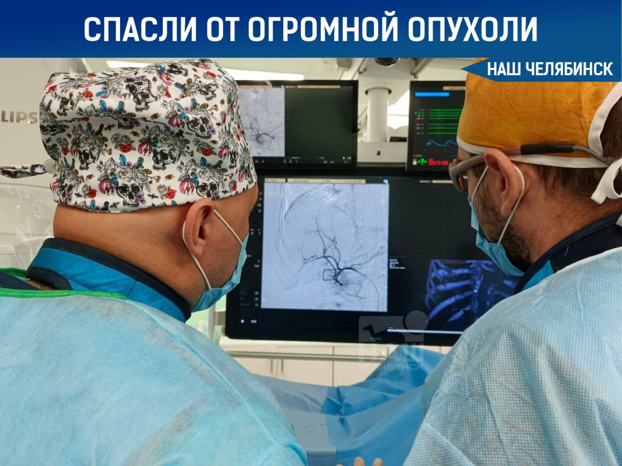  Челябинские онкологи спасли пациента с большой опухолью печени В онкоцентре провели операцию по удалению 8-сантиметровой опухоли печени у 50-летнего пациента из Миасса. Мужчина, у которого в 2011 году был диагностирован гепатит С, отказался от трансплантации органа. Врачи сначала провели химиоэмболизацию в кровеносные сосуды, питающие опухоль, вводятся лекарства вместе с частицами, блокирующими эти сосуды , чтобы уменьшить опухоль. После этого была выполнена резекция – удаление опухоли с сохранением большей части печени. Благодаря такому подходу удалось сохранить 80% органа. Сейчас пациент чувствует себя хорошо и продолжает работать. «Наш Челябинск» - новости без лапши! Подпишись!