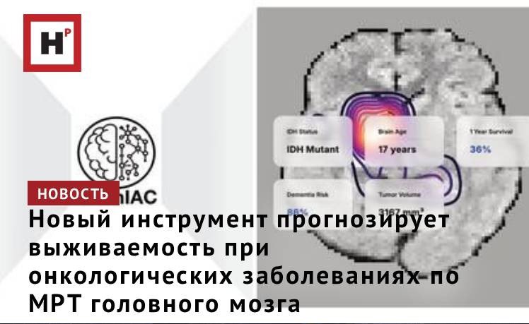 Ученые Массачусетского общего госпиталя им Бригама разработали надежную базовую модель ИИ способную анализировать данные МРТ головного мозга для решения множества медицинских задач в том числе определения возраста мозга прогнозирования риска развития деменции выявления мутаций в опухолях головного мозга и прогнозирования выживаемости при раке мозга Инструмент под названием BrainIAC превзошел другие модели ИИ ориентированные на решение более узких задач и был особенно эффективен при ограниченном объеме обучающих данных BrainIAC может успешно обобщать полученные знания на здоровых и аномальных изображениях и впоследствии применять их как для простых задач таких как классификация типов МРТ снимков так и для очень сложных таких как определение типов мутаций при опухолях головного мозга Модель также превзошла другие системы ИИ ориентированные на конкретные задачи в этих и других областях применения Фото Divyanshu Tak Mass General Brigham Подробнее на портале Научная Россия ии опухоли