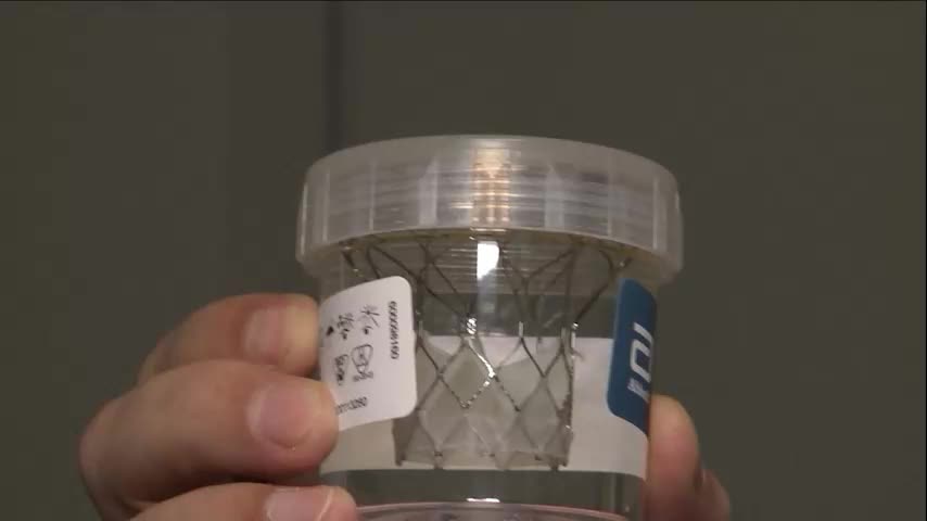 Три успешные операции на сердце с использованием отечественного оборудования проведены в НМИЦ хирургии имени А.В. Вишневского