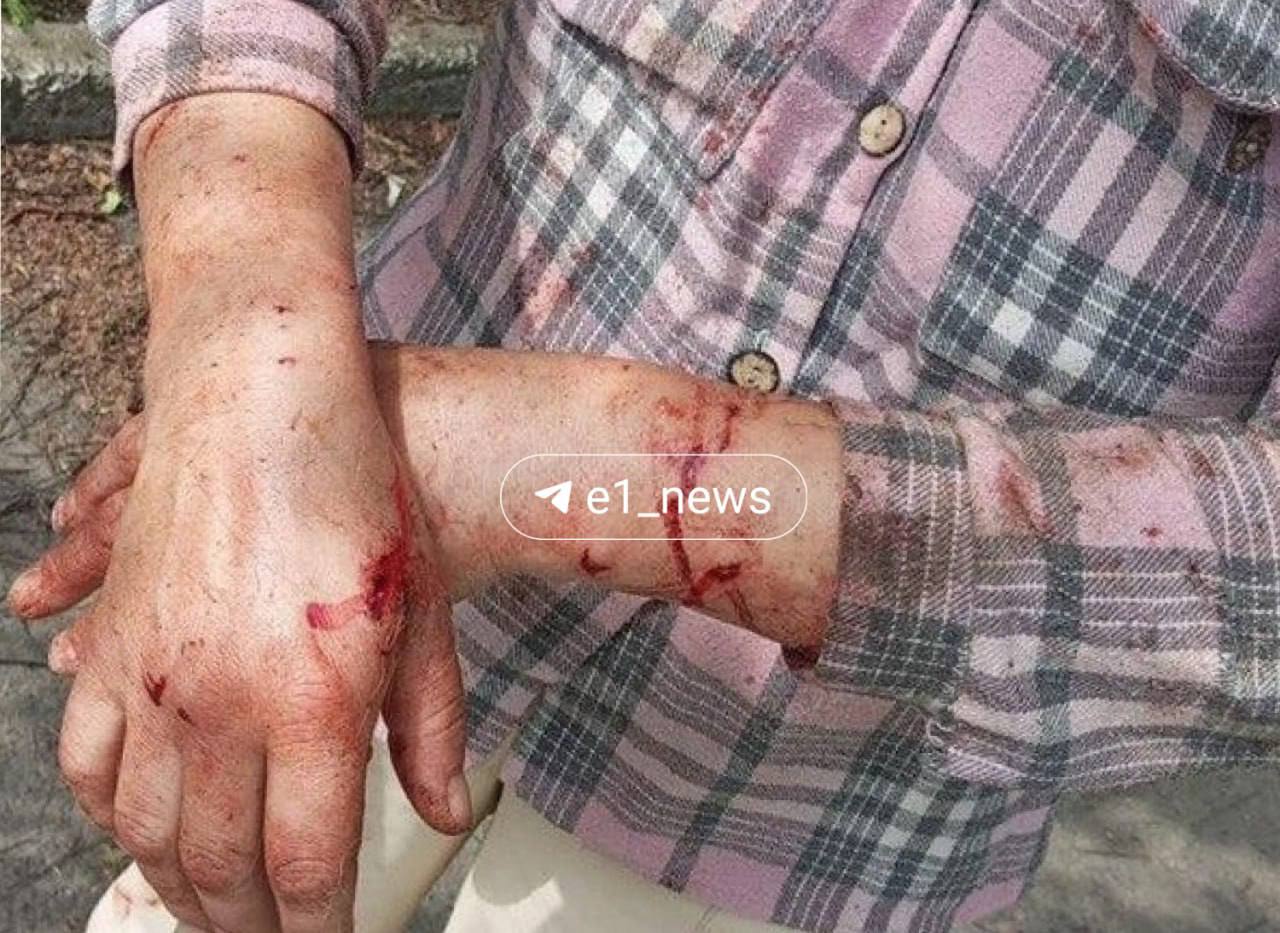 На Урале вводят карантин после укусов бешеной собаки После того как в городе Асбесте бездомная бешеная собака покусала шесть человек, власти намерены ввести в городе карантин. – Ограничения будут действовать два месяца. В это время специалисты будут проводить обходы по домам и бесплатно вакцинировать животных от бешенства, – передаёт комментарий областного департамента ветеринарии портал E1.RU., У жертв различные травмы, у одной женщины даже разорвано лицо. Пока больше случаев нападения животного не зафиксировано.