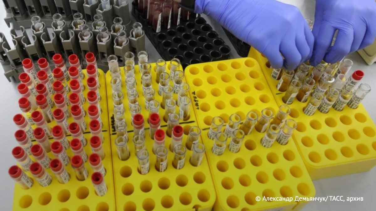 Ученые Роспотребнадзора создали первый в мире быстрый тест для диагностики гепатита С который позволяет определить наличие вируса всего за 25 30 минут вместо 1 5 2 часов Об этом сообщили ТАСС в пресс службе Роспотребнадзора Подпишись на ТАСС Мир