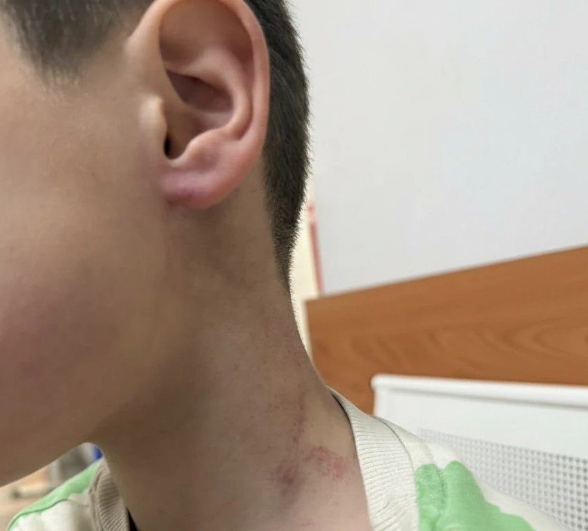 В Иркутском районе тренер детсада травмировал ребенка возбуждено уголовное дело В детском саду поселка Молодежный Иркутского района тренер по физкультуре нанес травмы воспитаннику По словам матери 25 сентября во время занятия мужчина схватил ребенка за шею поднял его и оттащил за ухо в угол У мальчика зафиксированы травмы головы лица и шеи О случившемся родители узнали от воспитателя только вечером Несмотря на обращение в полицию тренер продолжал работать а руководство сада пыталось его оправдать После публикаций в соцсетях и СМИ СУ СК России по Иркутской области возбудило уголовное дело по статье 156 УК РФ неисполнение обязанностей по воспитанию несовершеннолетнего Сейчас следователи устанавливают все обстоятельства инцидента Подпишитесь на канал