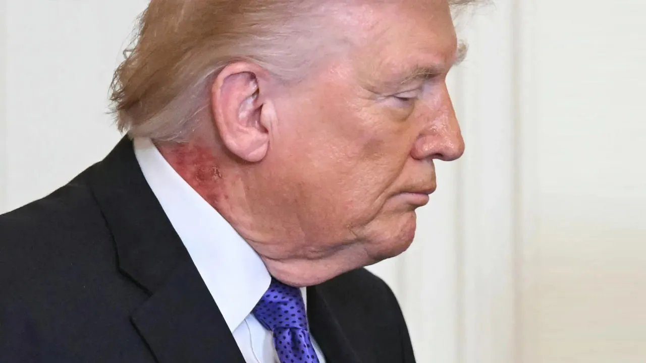 Трамп 26 мая отправится в Мэриленд на ежегодное стоматологическое и медицинское обследование которое будет включать плановую оценку здоровья президента сообщили в Белом доме Трампу периодически приходится опровергать слухи о своем плохом самочувствии Американский лидер настаивает на своем исключительном физическом и умственном здоровье утверждая что работает усерднее и больше любого президента в истории США