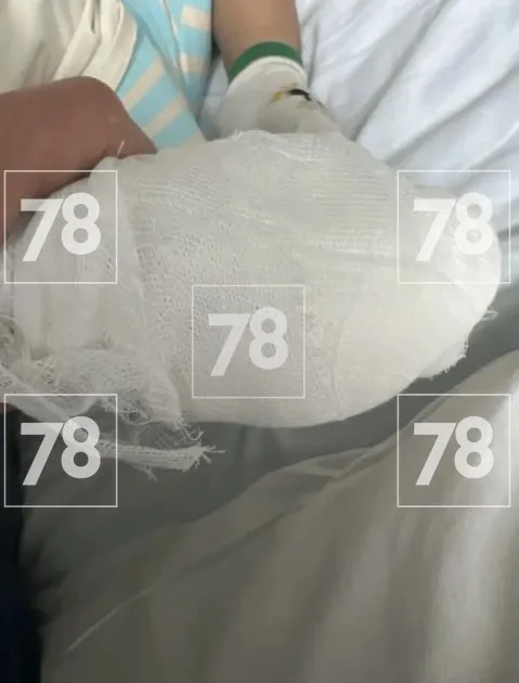 Двухлетнему малышу зажевало пальцы между ступеней эскалатора петербургского метро Как стало известно ребенок сидел на эскалаторе на станции Чернышевская и засунул пальцы в щель между двух ступенек Услышав крик мать тут же попыталась вытащить руку сына Но подъёмник остановился не сразу дежурная сначала не поняла что произошло наверху Пальцы удалось извлечь однако теперь два из них на правой руке скальпированы а сам ребёнок находится в хирургическом отделении больницы в состоянии средней тяжести   Telegram барахлит читайте нас в MAX Прислать новость