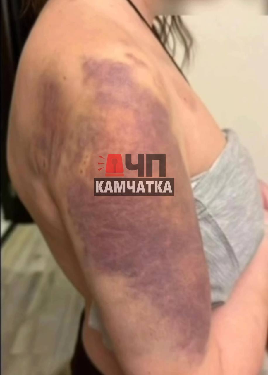 На Камчатке мужчину будут судить за ужасное обращение с женщиной и собакой В Петропавловске-Камчатском завершили расследование дела против 38-летнего местного жителя. Его обвиняют в страшных вещах: избиении женщины, угрозах убийством и издевательствах над собакой. Всё произошло в октябре прошлого года. Мужчина, ослеплённый ревностью, жестоко избил свою сожительницу - бил её кулаками больше 20 раз, связал скотчем, резал ножом и угрожал убить. Женщина чудом смогла написать родным в мессенджер, и те помогли ей сбежать через окно, об этом ранее сообщал "ЧП Камчатка". Но это ещё не всё. За несколько дней до этого тот же мужчина, снова из-за ревности, посадил собаку женщины в стиральную машину и включил её. Хозяйке пришлось выламывать дверцу, чтобы спасти питомца. К счастью, ветеринары смогли помочь животному. Сейчас обвиняемый сидит в следственном изоляторе и не признаёт свою вину. Дело уже передали в суд, где ему предстоит ответить за все эти ужасные поступки. Если его признают виновным, он может получить серьёзный срок. Эта история шокировала многих жителей Камчатки своей жестокостью.