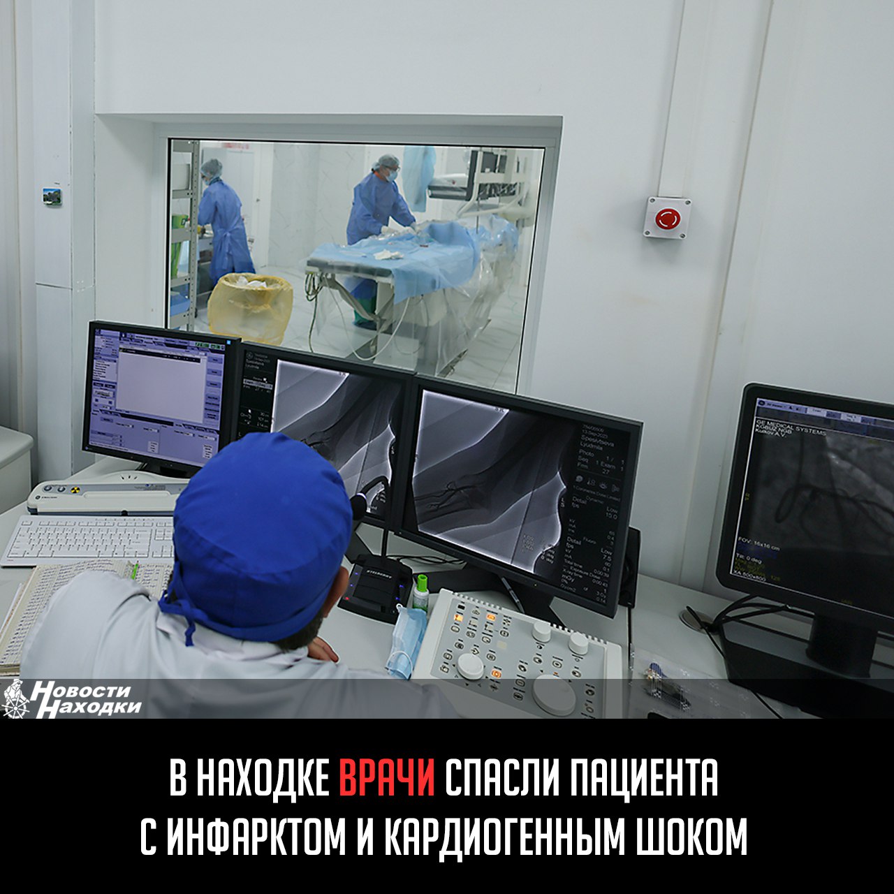 65-летний мужчина поступил в крайне-тяжелом состоянии. Ночью он почувствовал себя плохо, спустя 3 часа обратился за помощью. С критически низким давлением скорая доставила больного в реанимацию.  На фоне обширного инфаркта развился кардиогенный шок — сердце было не в состоянии обеспечить кровоснабжение жизненно важных органов. Прогноз при этой патологии обычно неблагоприятный.  Требовалось срочно стабилизировать состояние. Пока больным занимались реаниматологи и кардиологи, рентгенэндоваскулярная бригада готовила операционную с ангиографическим комплексом. Он дает возможность оценить состояние сосудов и проводить ювелирные хирургические манипуляции внутри артерий и вен.  Обследование показало, что у полностью перекрыта одна из основных артерий сердца, некроз поразил все слои жизненно важного органа. После подтверждения диагноза больного прооперировали  Две недели его выхаживали реаниматологи и кардиологи. Сейчас он вернулся к повседневной жизни