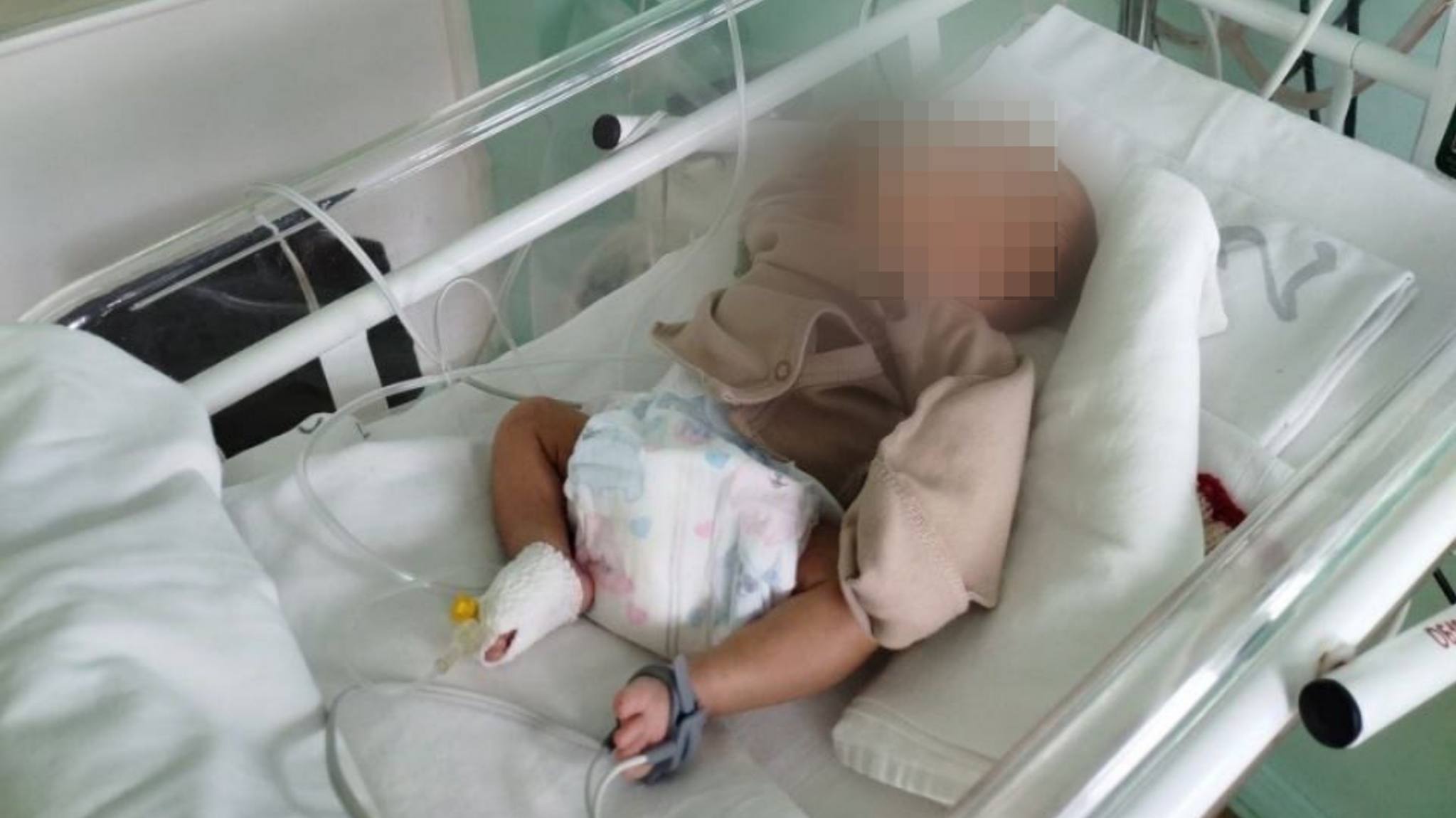 Недоношенного мальчика весом 850 г родившегося на 14 недель раньше срока выхаживали врачи Липецка Пензы и Москвы Первое время он находился в перинатальном центре в Липецке потом перенес несколько операций в федеральных клиниках и был выписан домой с весом 3320 г Подписаться Написать нам