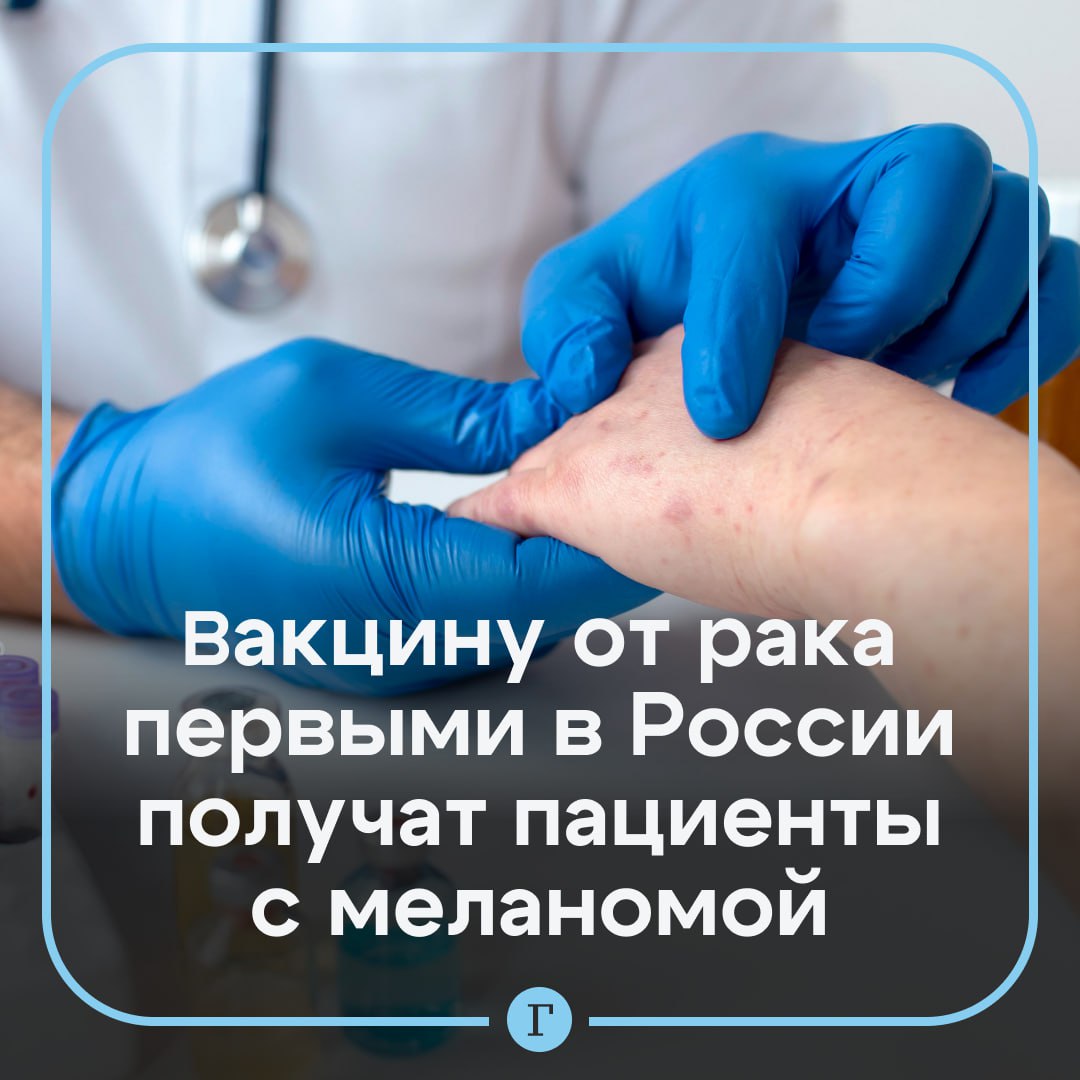 Первыми отечественную мРНК-вакцину от рака получат пациенты с меланомой. Об этом в преддверии ПМЭФ-2025 рассказал «Газете.Ru» директор Центра Гамалеи, академик РАН Александр Гинцбург. Через две недели академик Андрей Каприн получит официальное удостоверение от Росздравнадзора для проведения первых двух этапов создания вакцины на основе мРНК. А Гинцбургу выдадут разрешение на синтез мРНК. «В первую очередь пойдут больные с меланомой. Меланомы содержат наибольшее количество мутаций, как и рак легкого, но с меланомой легче работать экспериментально, поэтому все, и мы в том числе, начали с меланомы», — рассказал академик. Если методика заработает на этих видах рака, по словам Гинцбурга, онкологи должны придумать, как это распространять на другие опухоли. Подписывайтесь на «Газету.Ru» Участвуйте в розыгрыше!