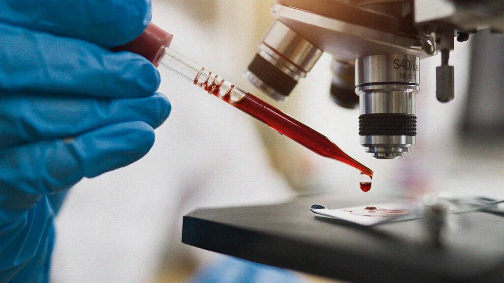 В Иркутской области Хакасии и Коми растет заболеваемость ВИЧ В ряде регионов России фиксируется рост заболеваемости ВИЧ инфекцией В Иркутской области с января по май 2025 года выявлено 611 новых случаев заражения на 1 13 меньше чем за аналогичный период 2024 года 618 случаев Однако общее число инфицированных в регионе превышает 31 тысячу человек В Хакасии за восемь месяцев 2025 года зарегистрировано 180 новых случаев что на 11 больше чем за тот же период прошлого года Особенно обеспокоили власти рост заражений среди граждан старше 50 лет их доля увеличилась с 14 7 в 2024 году до 21 6 в 2025 году В Коми за первые четыре месяца 2025 года выявлено 89 случаев ВИЧ что на 7 выше показателя за аналогичный период 2024 года По данным Роспотребнадзора основной путь передачи инфекции половой УтроNEWS