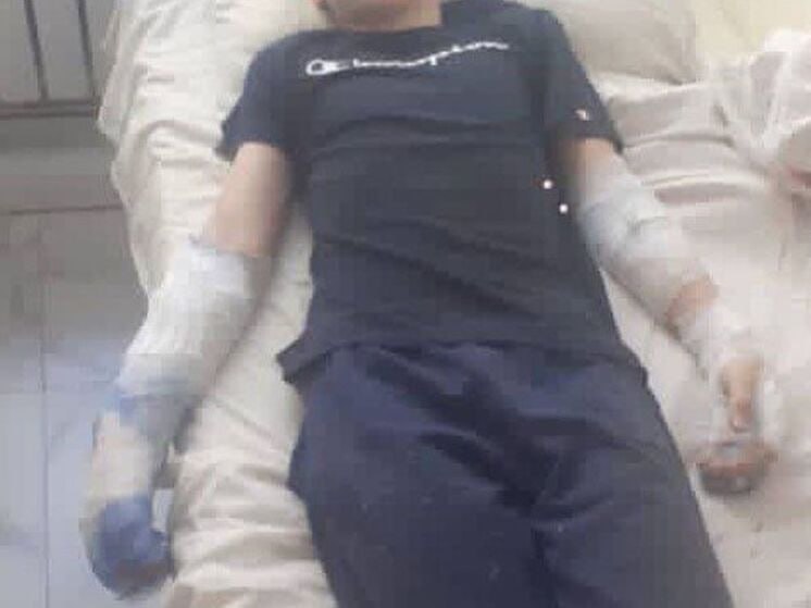 В Дагестане 12-летний мальчик, играя во дворе, получил удар током, облокотившись на дерево с оголенными проводами от трансформатора. Ребенку ампутировали два пальца на руках из-за ожогов 3 и 4 степени. Ему предстоит операция по пересадке кожи и реабилитация.