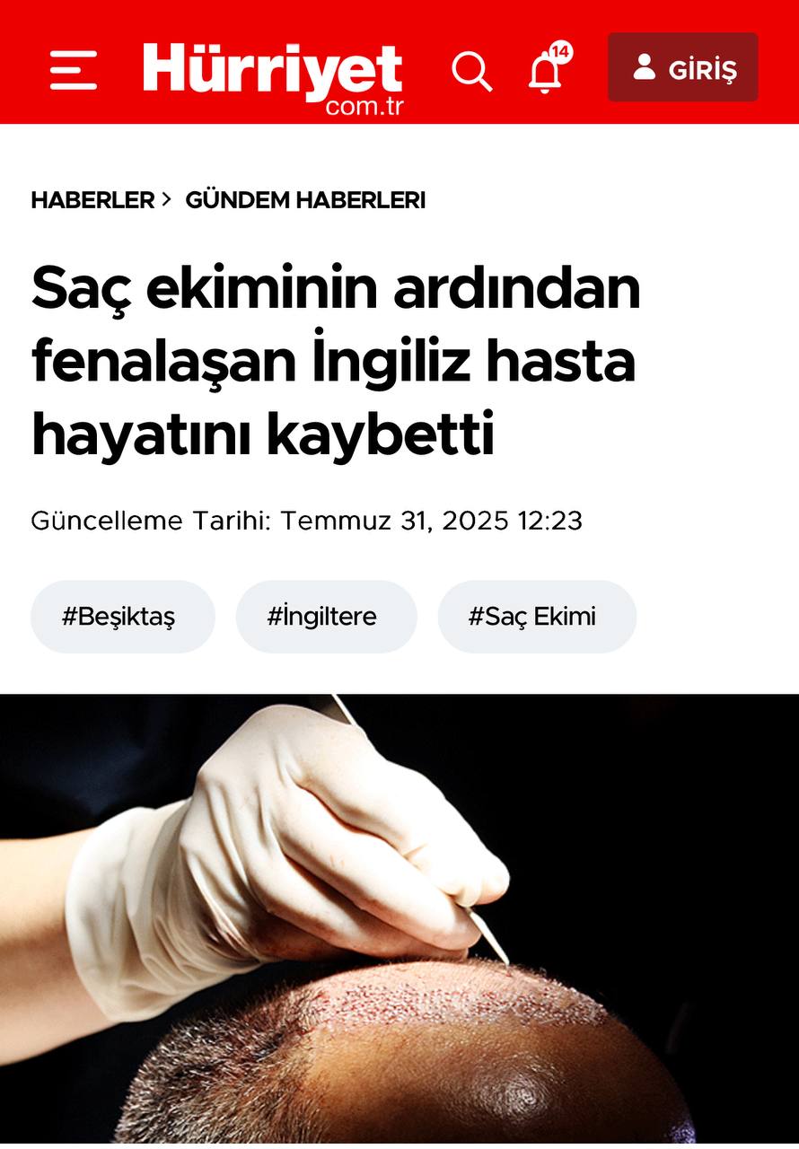 Турист из Британии скончался в Стамбуле после пересадки волос  38-летний британец записался на прием в частную клинику района Бешикташ и 28 июля прошел процедуру. Вскоре после пятичасовой операции пациент почувствовал себя плохо. Его экстренно госпитализировали в ближайшую больницу, сообщает турецкая ежедневная газета Hürriyet.  Мужчина был доставлен в отделение интенсивной терапии, где позднее скончался, несмотря на все попытки врачей его спасти.  По данным Hürriyet, тело британца сначала отвезли в Институт судебной медицины, а потом отправили на родину. Полиция начала расследование по статье «убийство по неосторожности», причина смерти до сих пор выясняется