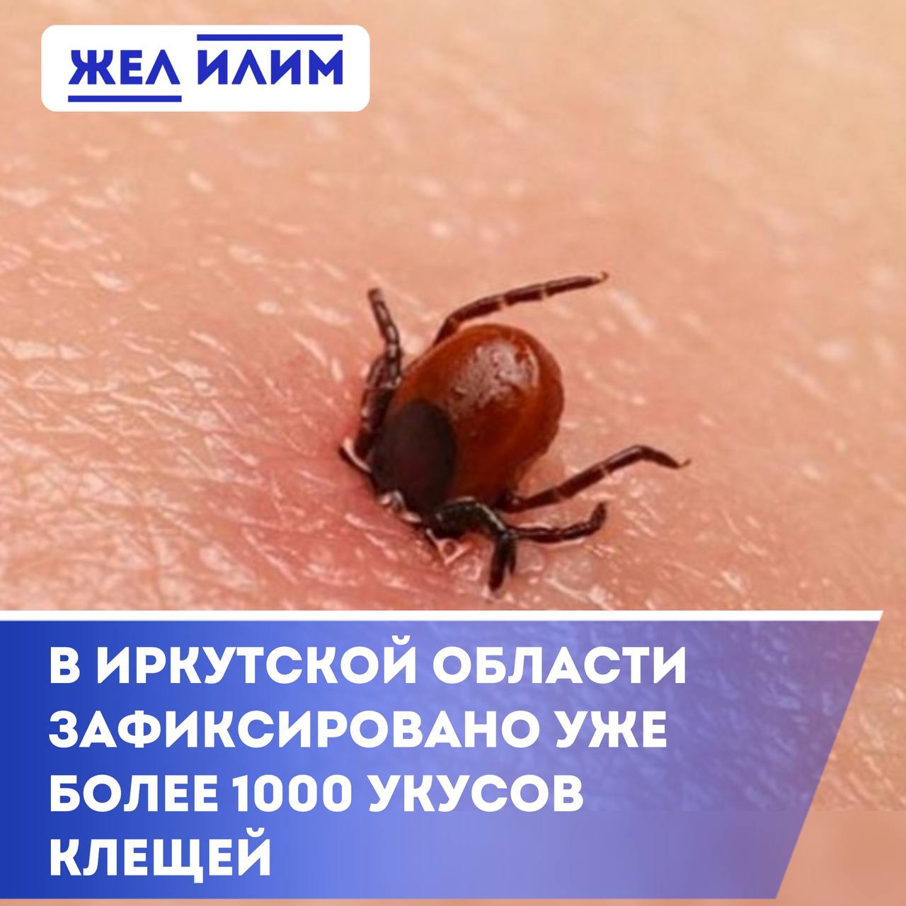 В Иркутской области за неделю более 1 100 человек пострадали от укусов клещей С 5 по 11 мая в медучреждения обратились 1 137 человек. У троих диагностировали клещевой боррелиоз, ещё у троих — риккетсиоз, сообщает Роспотребнадзор. Из 1 714 исследованных клещей: 18 заражены вирусом энцефалита, 207 — боррелиозом, 100 — другими инфекциями. Если укусил клещ: 1. Удалите клеща лучше в больнице как можно скорее пинцетом или нитью, раскачивающими движениями. Не давите его и не смазывайте маслом. 2. Обработайте место укуса антисептиком — спиртом, йодом или хлоргексидином. 3. Сохраните клеща в герметичную баночку с кусочком влажной ваты и отнесите в лабораторию на анализ. 4. Обратитесь к врачу — даже если самочувствие нормальное. Врач оценит риски и при необходимости назначит профилактику: антибиотики или инъекцию иммуноглобулина при подозрении на энцефалит. Используйте репелленты, носите закрытую одежду и проводите самоосмотры каждые 15–20 минут.