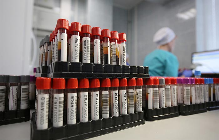 В России обнаружено 114 случаев заболевания новым штаммом COVID-19 XFG  Stratus, Стратус   Первый случай заражения штаммом XFG в РФ был обнаружен 24 апреля 2025 года, сообщил заведующий лабораторией геномных исследований ЦНИИ эпидемиологии Роспотребнадзора Камиль Хафизов.  По данным ЦНИИ, для XFG характерны высокая заразность, симптомы в основном легкие, часто отмечается сиплость голоса как характерная особенность.   Фото: Кирилл Брага/РИА Новости