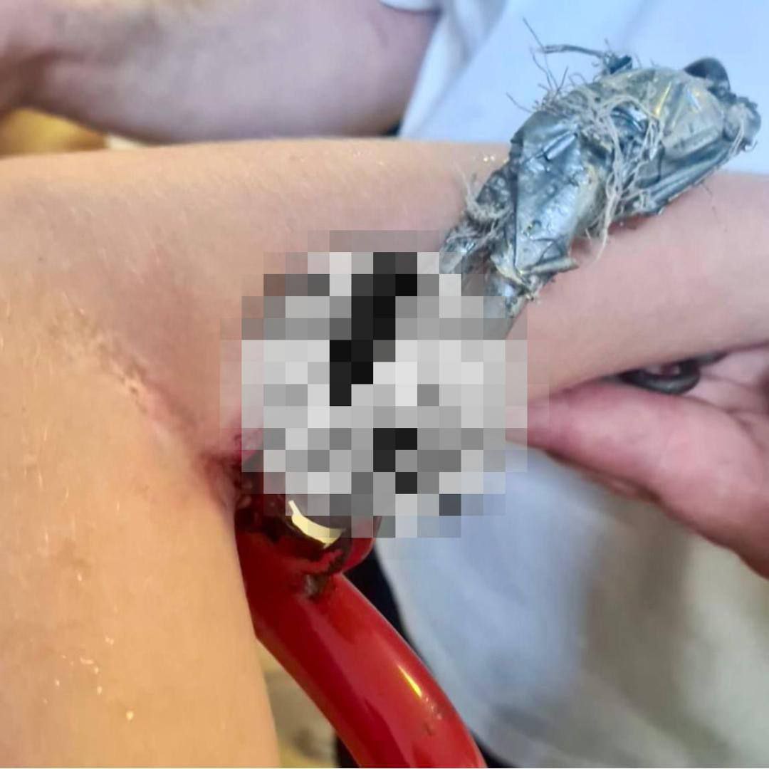 В Подмосковье 10-летний мальчик пострадал на детской площадке — в его руку вонзился карабин от качелей. Ребенка госпитализировали в Московский центр охраны материнства и детства, где извлекли инородный предмет и оказали необходимую помощь. Жизни и здоровью ребенка ничто не угрожает.