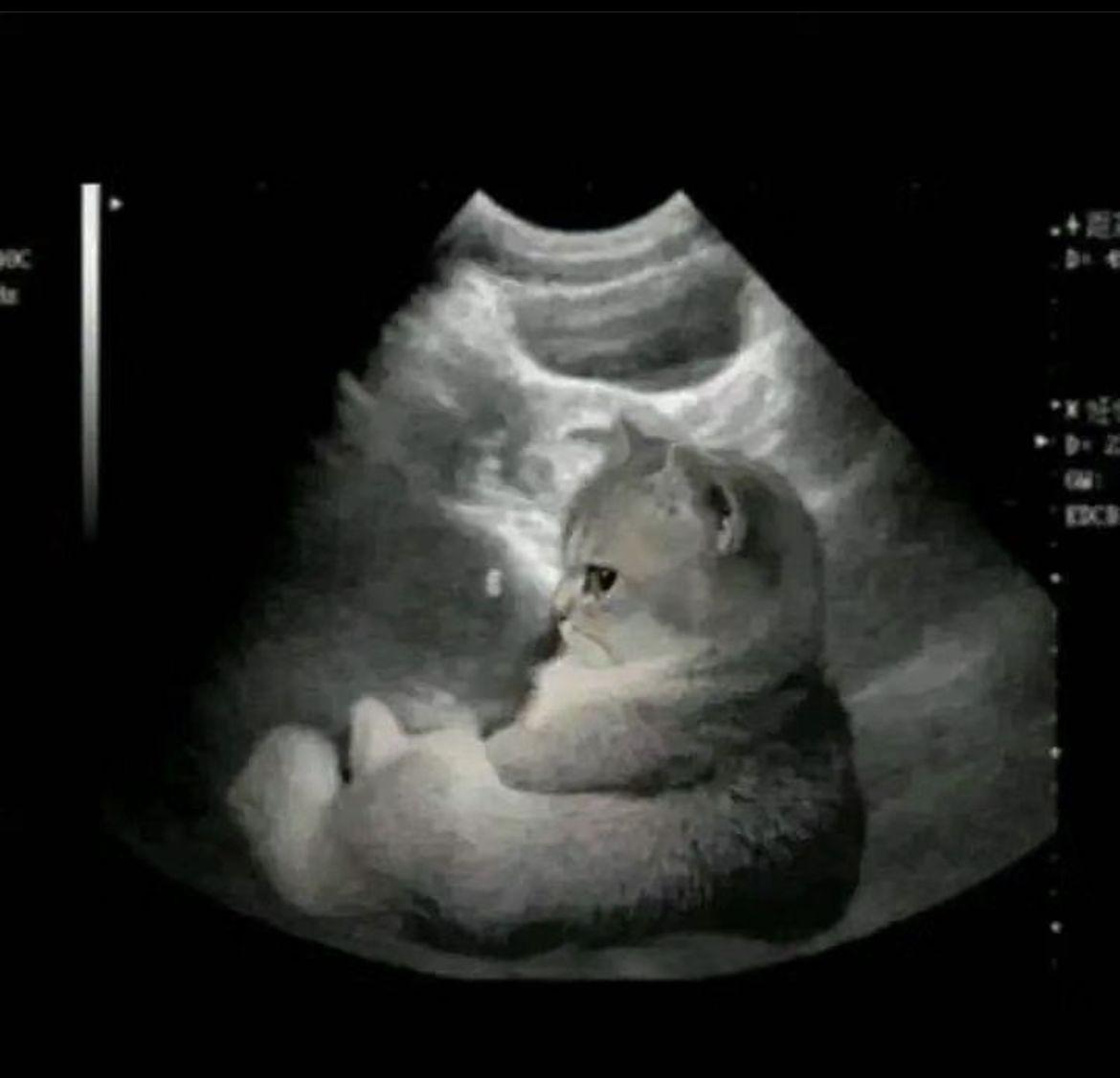 В Татарстане запустят региональную программу Охрана материнства и детства С 2025 го по 2030 год на нее планируют выделить почти 2 85 миллиарда рублей Среди ключевых задач проекта снижение младенческой и материнской смертности борьба с бесплодием и абортами создание современной инфраструктуры непрерывное обучение врачей и другие действия   inde io news pochti 285 milliarda rublej vydelyat na programmu ohrany materinstva i detstva v tatarstane