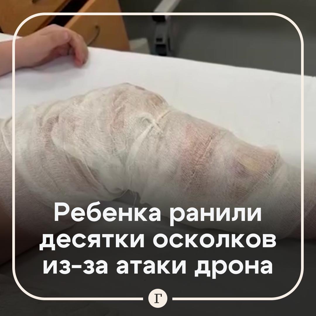 Врачи достали около десяти осколков из тела восьмилетнего мальчика пострадавшего при атаке дронов в подмосковном Красногорске По словам медиков из детского центра имени Рошаля жизненно важные органы не повреждены суставы не задеты Мальчик находится в стабильном состоянии с ним в отделении сидит бабушка У родственников ребенка мамы и дедушки травмы средней тяжести Пожелаем скорейшего выздоровления