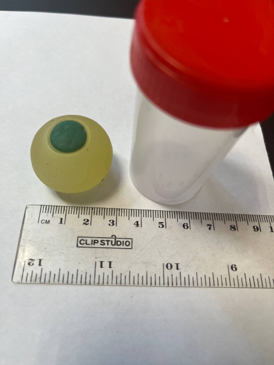 Челябинские врачи извлекли из кишечника школьника силиконовый глаз   gubernia74 ru articles society 1136622 Врачи Городской клинической больницы 1 Челябинска рассказали об удивительном случае в своей практике к ним из инфекционного стационара другой больницы экстренно доставили девятилетнего школьника с симптомами отравления или инфекционного заболевания тошнота рвота и боли в животе Однако подтвердить диагноз инфекционисты не смогли В процессе исследований в ГКБ 1 выяснилось что у мальчика серьезная непроходимость в кишечнике Причиной стал проглоченный силиконовый глаз   t me chgub