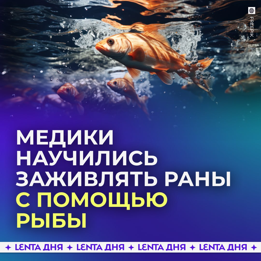 Российские учёные создали ранозаживляющие покрытия из рыбы В Нижнем Новгород предложили использовать коллаген трески для ускорения заживления ран и защиты от инфекции Новые покрытия самостоятельно препятствуют развитию бактерий и плесени Коллаген трески максимально похож на человеческий что делает материал безопасным и биосовместимым Кроме того это недорогой и возобновляемый ресурс не несущий риска заражения По словам исследователей отечественных аналогов таких покрытий пока нет а эффективность новых материалов превышает существующие коммерческие варианты   за инновации в медицине Подпишись на Ленту дня MAX ТГ Участвуй в розыгрыше