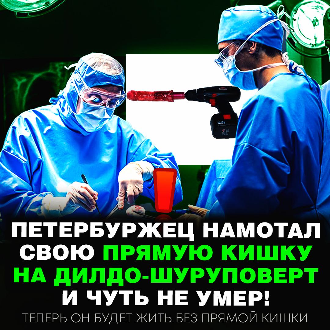 В Питере извращенец вставил себе в задницу дилдо-шуруповерт и чуть не умер Молодая пара решила испытать дилдодрель в сексе, но они случайно врубили огромную скорость на девайсе — мужику разорвало кишки и ближайшие органы. Бедолага выжил, теперь ему придётся существовать без прямой кишки. — bruh... Рифмы и Морген