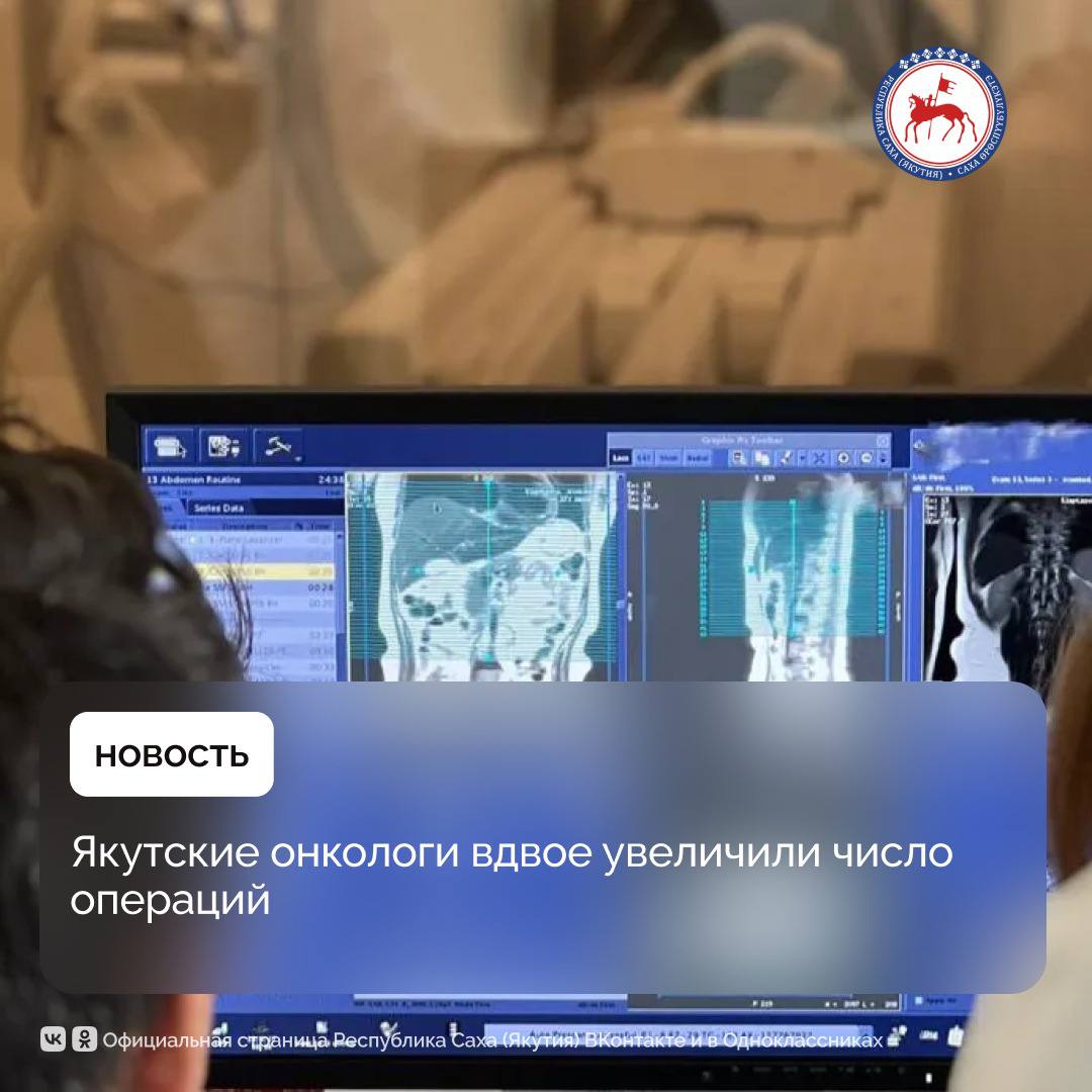 В хирургических отделениях Якутского республиканского онкологического диспансера выполнено более 4500 операций, что почти на 58% больше по сравнению с 2023 годом.  За 2024 год врачи-онкологи провели более 52 500 консультаций в поликлинике, что на 18% больше, чем годом ранее.  Особое внимание уделяется малоинвазивным методам лечения, которые позволяют выполнять сложные операции с минимальными разрезами и быстрее восстанавливать пациентов. Такие подходы активно применяются при лечении опухолей грудной клетки, колоректальном раке, онкоурологических заболеваниях и новообразованиях женской половой системы.  #Здравоохранение
