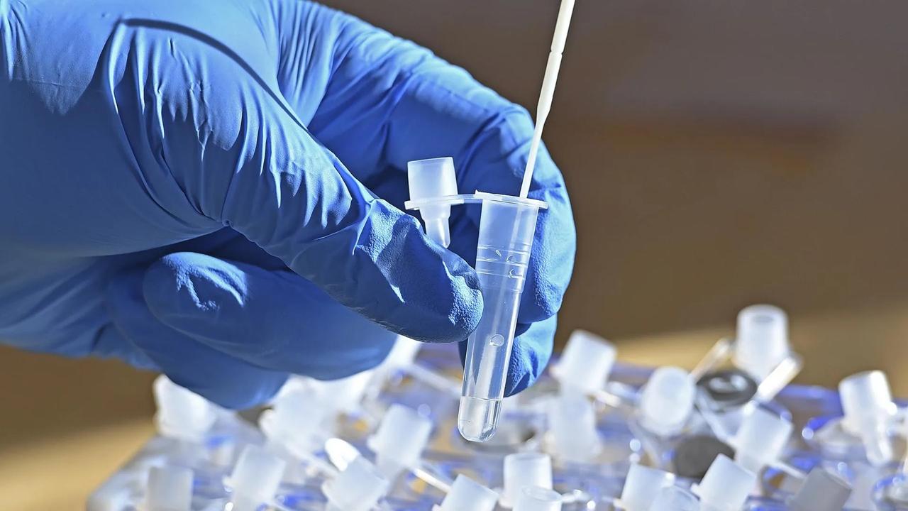 В сточных водах Гамбурга обнаружен полиовирус Впервые за десятилетия в Германии выявлены дикие полиовирусы Возбудитель обнаружен в пробе сточных вод из Гамбурга сообщает Deutschlandfunk Власти города и Институт Роберта Коха RKI оценили риск для населения как очень низкий Они описали случай как единичный и указали на высокий уровень вакцинации населения По данным RKI это дикий полиовирус 1 го типа который в настоящее время циркулирует только в Афганистане и Пакистане У людей с недостаточной вакцинацией он может вызвать полиомиелит Последний случай инфекции диким полиовирусом в Германии зарегистрирован в 1990 году последние завозные случаи в 1992 м Полиомиелит это острая вирусная инфекция которая повреждает нервные клетки головного и спинного мозга и в тяжелых случаях вызывает паралич конечностей тела и дыхательных мышц В основном полиомиелитом болеют дети