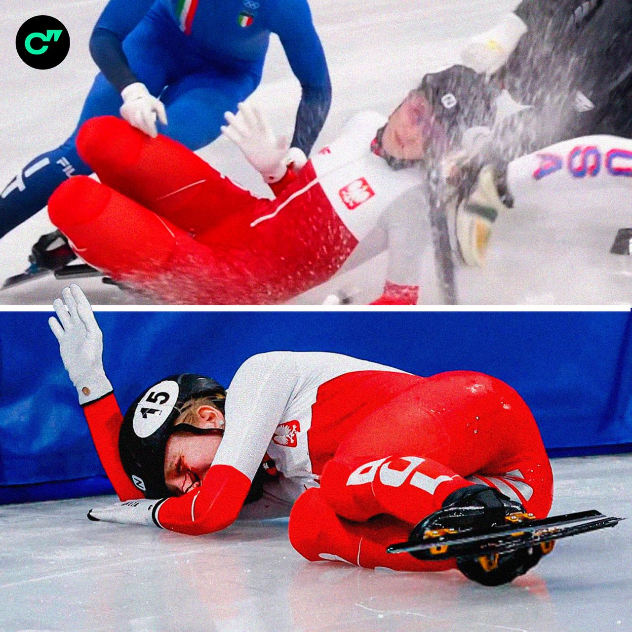 Конек попал в лицо польской шорт трекистке Камиле Селье во время завала в забеге на 1500 м на Олимпиаде ее увезли на носилках Прямо на арене Камиле диагностировали сильный отек глаза она не могла его открыть порез на щеке повреждение скулы и кости под глазницей   Подписывайтесь на Спортс в Max