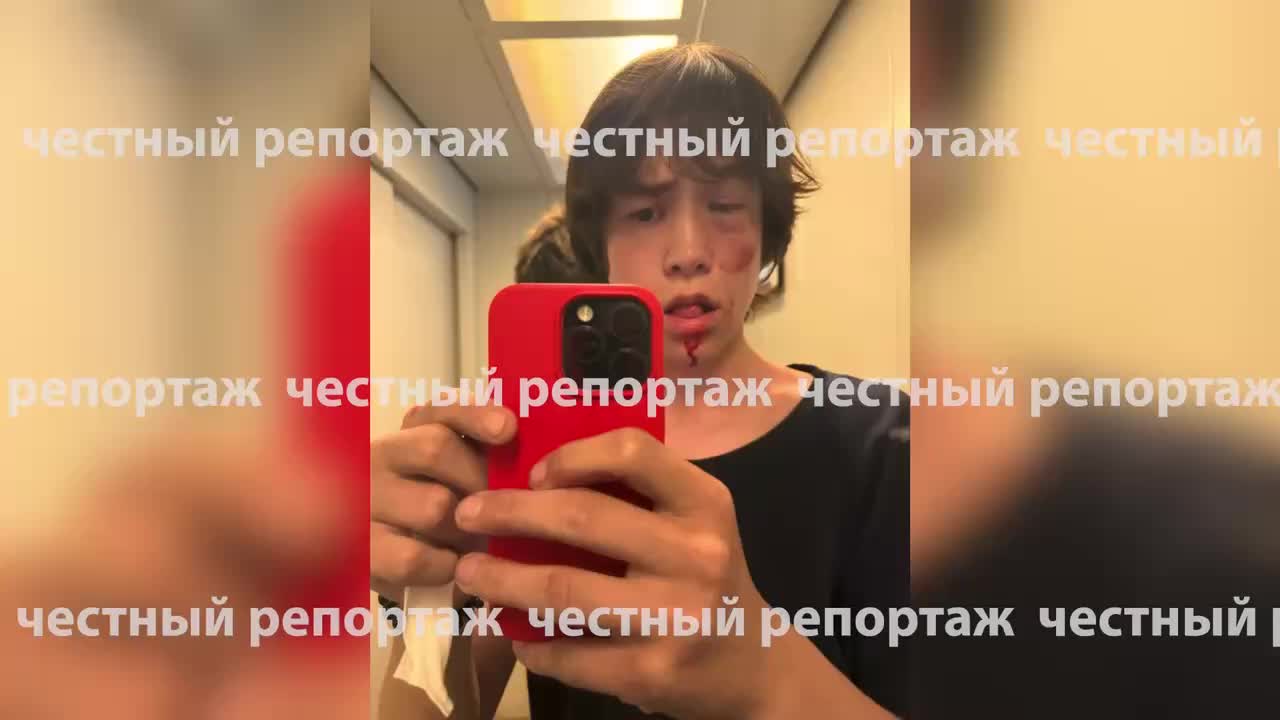 В Ростове-на-Дону пьяный водитель сбил подростка на электросамокате