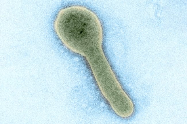 Государственный центр вирусологии Вектор выявил в России больше 60 вирусов которые ранее были неизвестны Об этом гендиректор центра Александр Агафонов заявил на форуме Золотая долина в Новосибирске Специалисты в рамках проекта Виром России изучали образцы из 50 регионов страны Фото Getty Images Подписаться на Российскую газету Читать нас в MAX