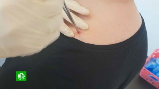 С начала июля клещи покусали больше 600 петербуржцев. 19 из них заболели боррелиозом или энцефалитом. Больше всего случаев зафиксировали в Курортном районе. -Петербург Буст канала